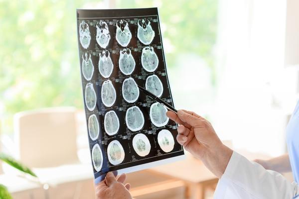 Traumatic brain injuries are common after car accidents